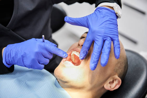 Best Emergency Dental Care for Sports Injuries in Ashburn, GA